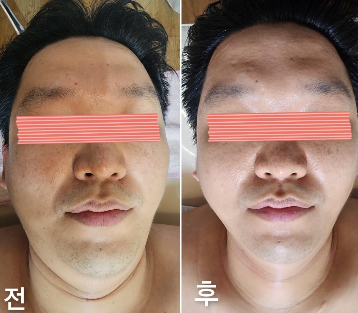 작은얼굴 디자인