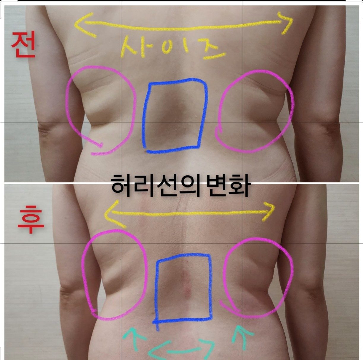 등디자인
